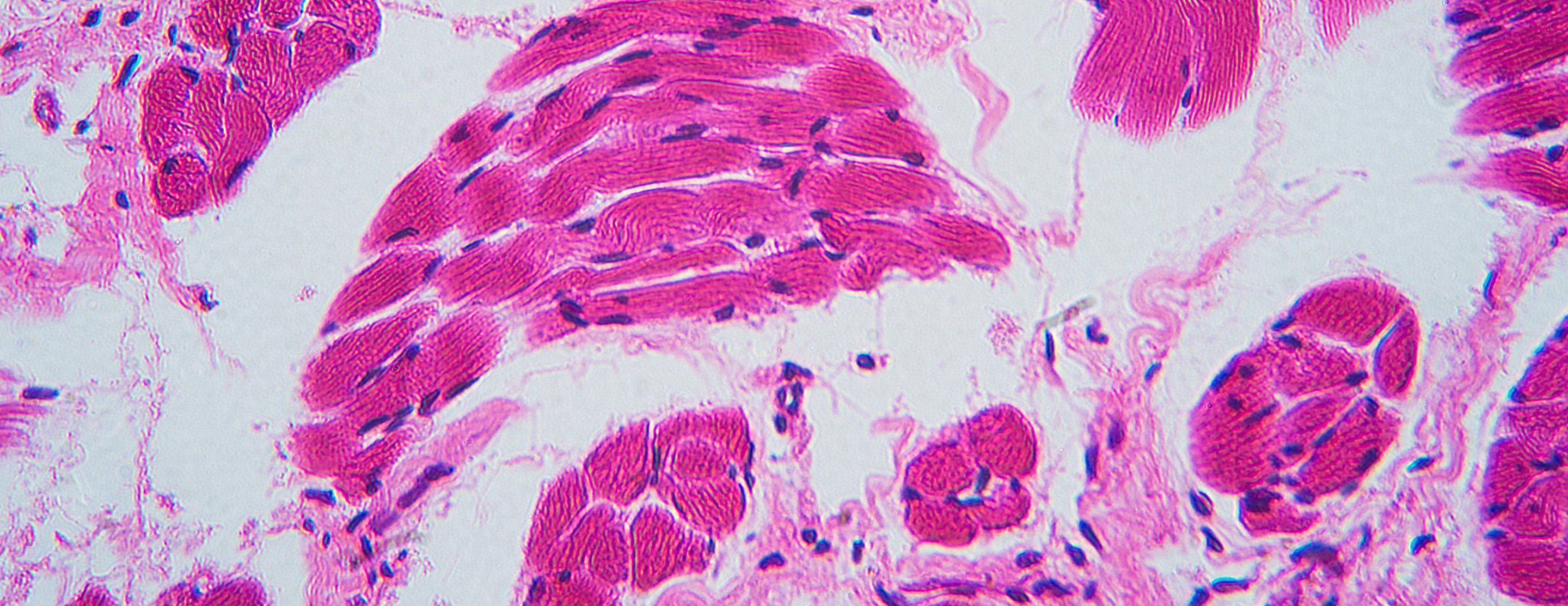 Biopsy On Tongue