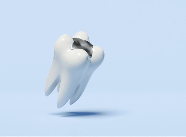 Black Lines Molars Black Lines Molars