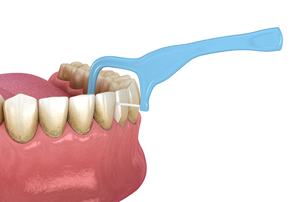 Bloody Gums Flossing