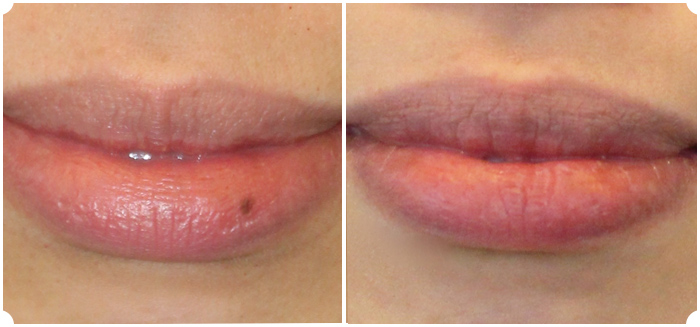 Blue Lip Mark Removal Guide