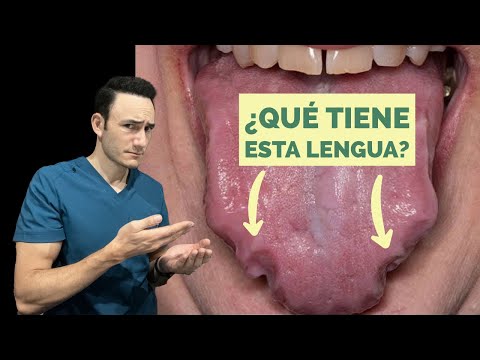 Bolas Atras De La Lengua