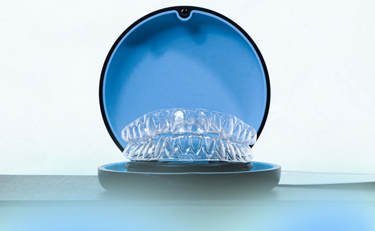 Braces Alternative For Adults Braces Alternative For Adults