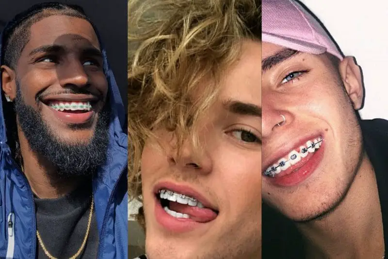 Braces Best Colors Braces Best Colors
