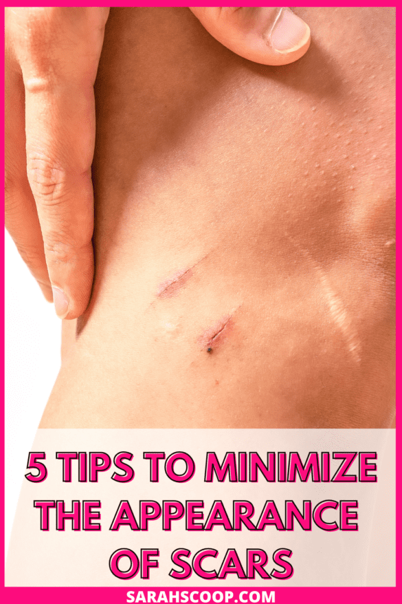 Braces Scars: Minimize Damage With Expert Tips