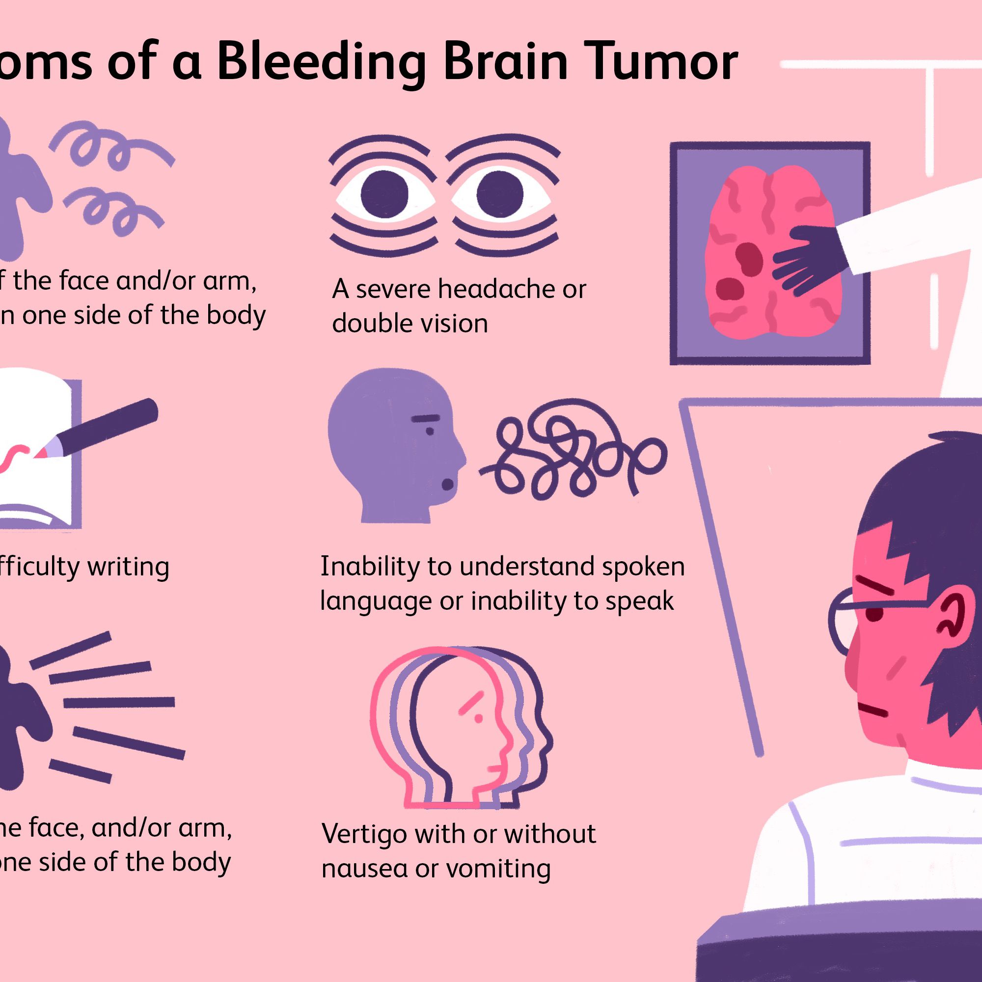 Brain Hemorrhage Recovery Time Causes And Symptoms Brain Hemorrhage Recovery Time Causes And Symptoms