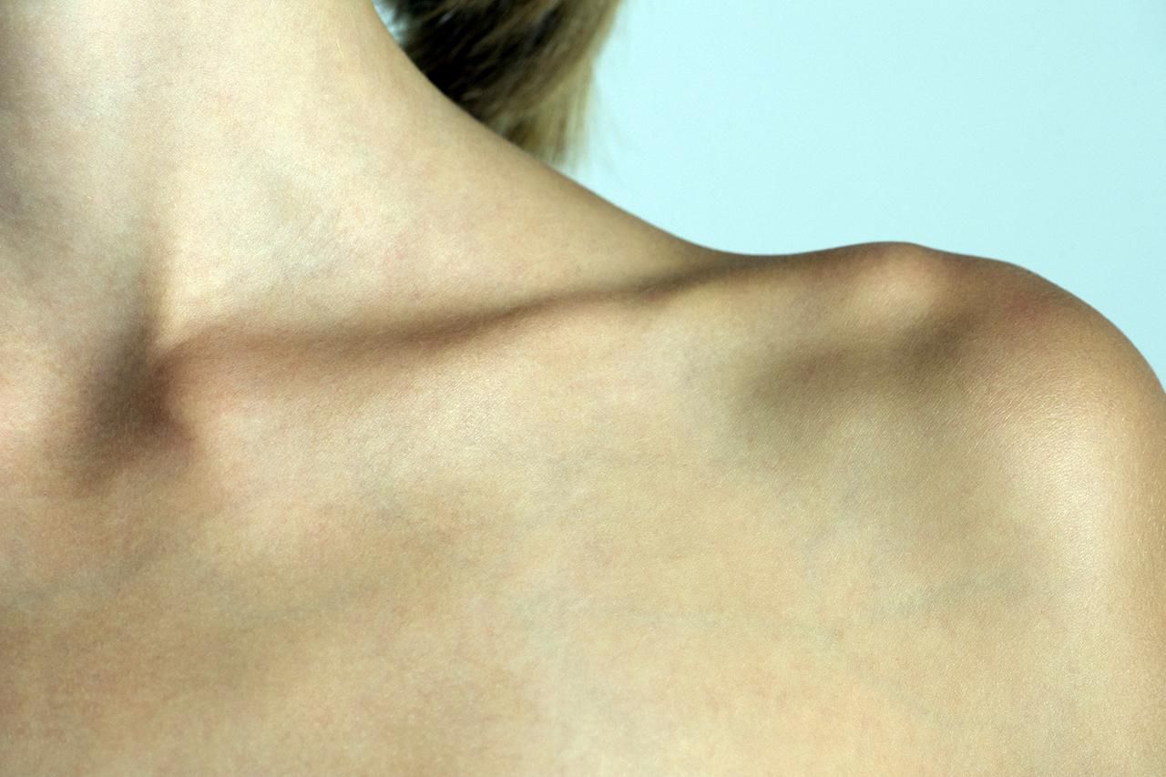 Broken Clavicle Rehab Exercises