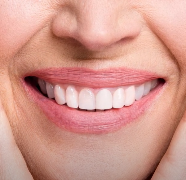 Can A Crown Be Whitened
