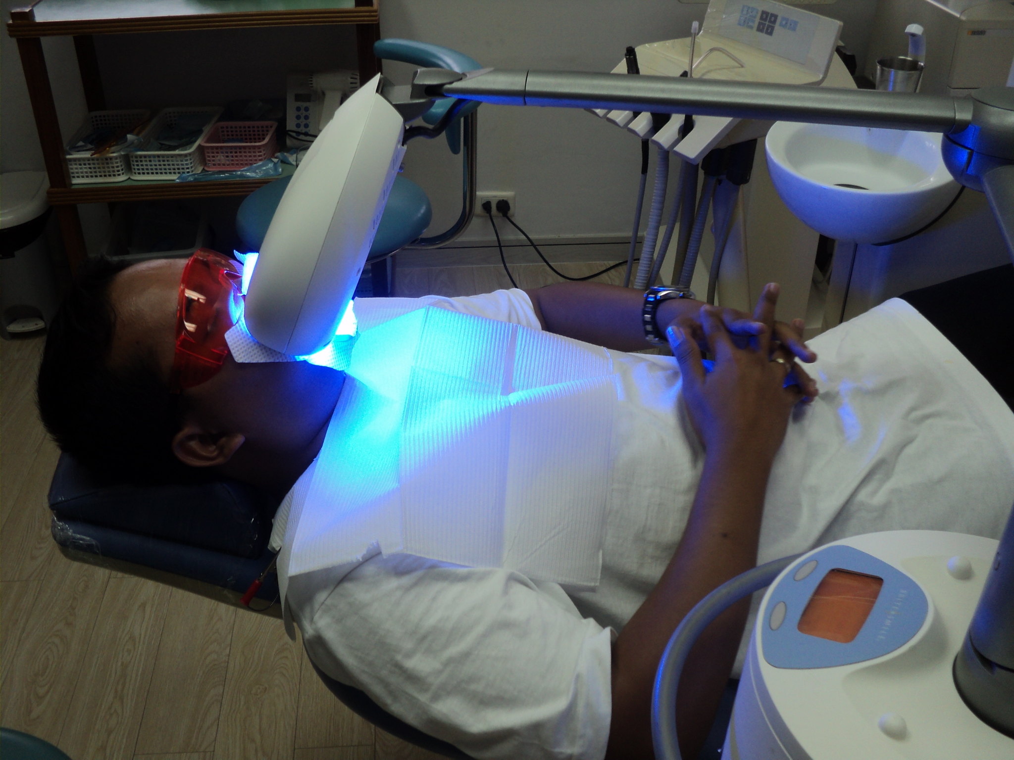 Can Tooth Crowns Be Whitened