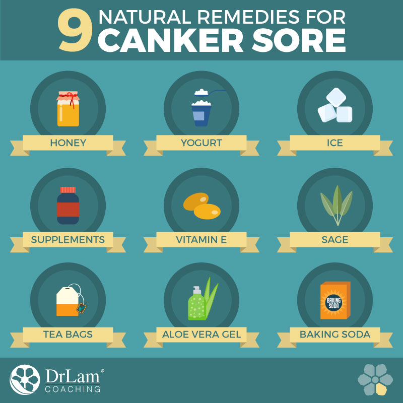 Canker Sore Near Tonsils: Fast Relief Solutions