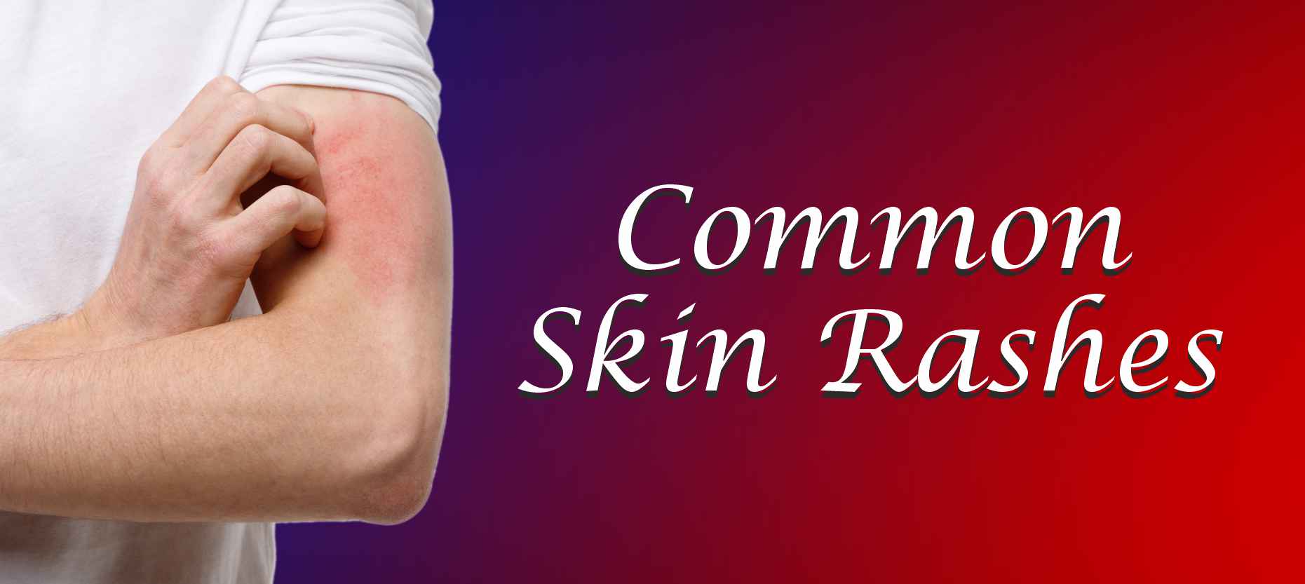 Causes Of Skin Rashes With Itching At George Keys Blog