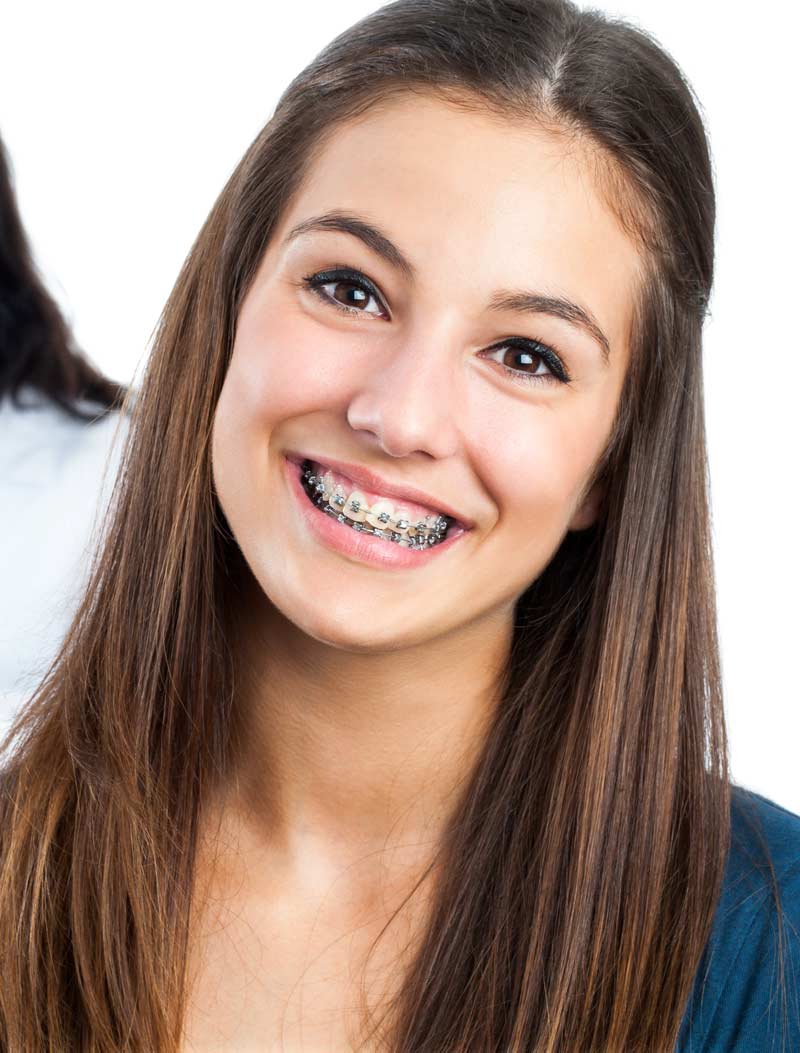 Cheap Braces For Adults