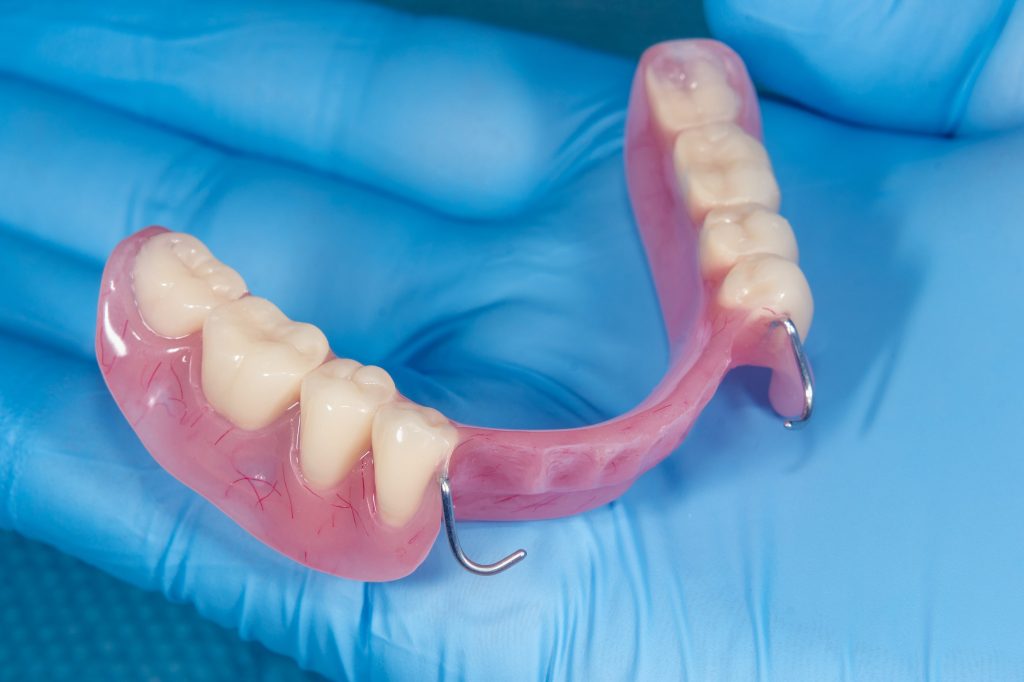 Cheap Bridges Teeth