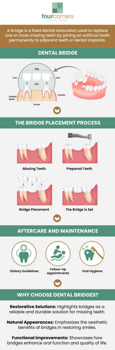 Cheap Dental Bridges Near Me