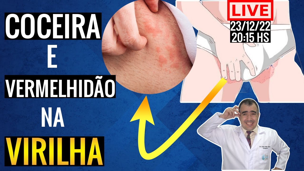 Coceira Na Virilha