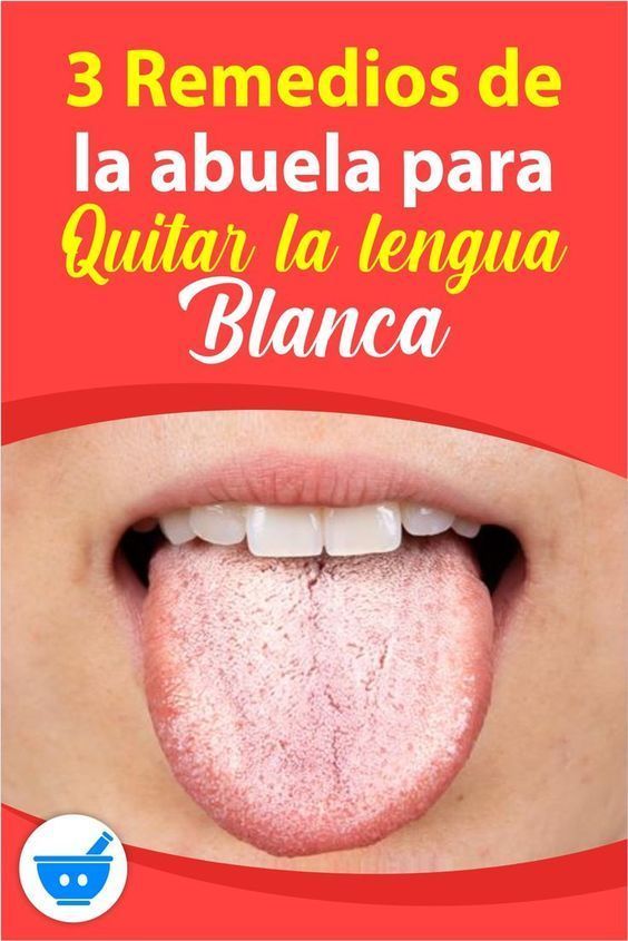 Como Quitar La Lengua Blanca