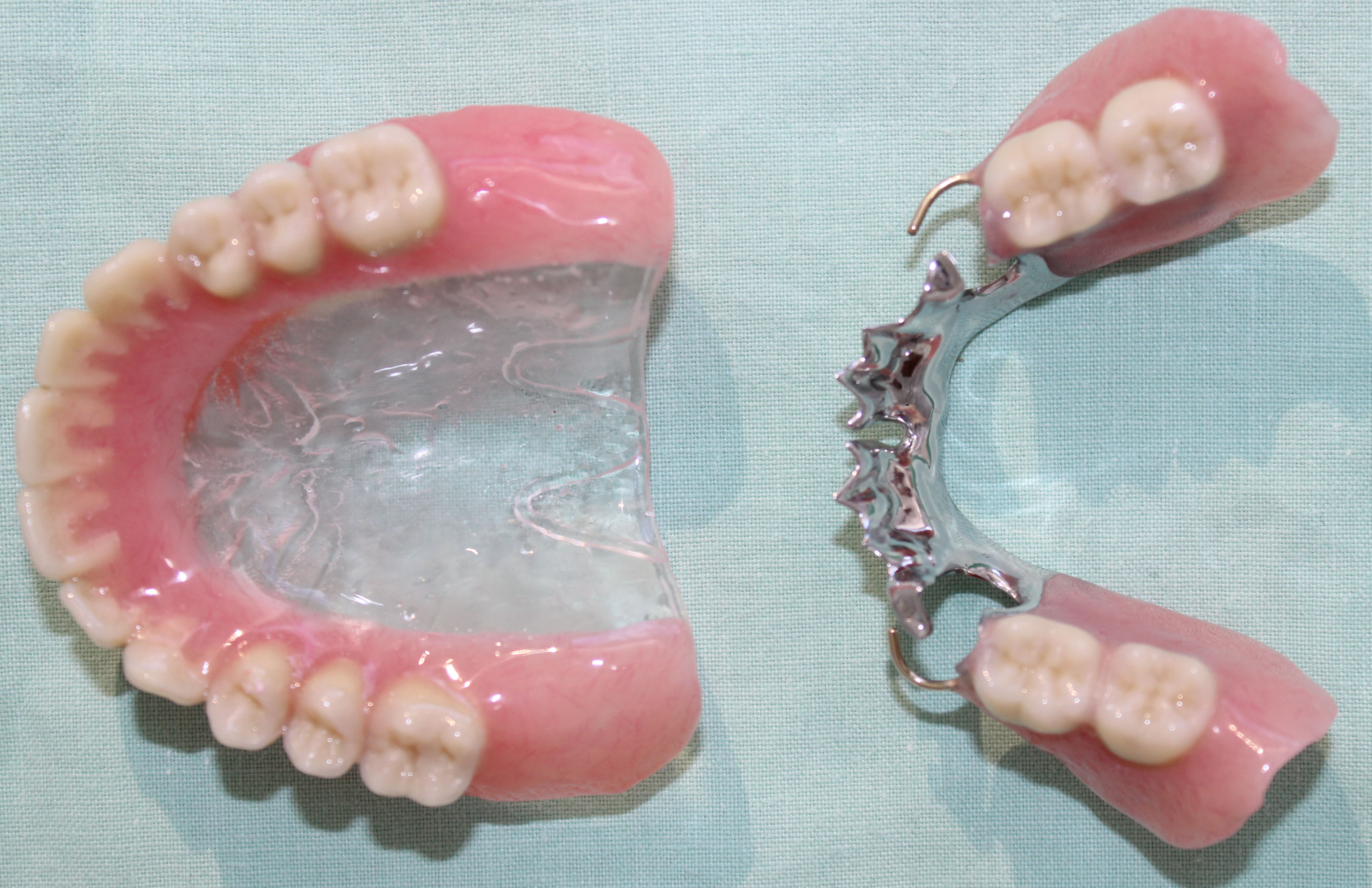 Complete Dentures Northland Prosthodontics Northland Denture Complete Dentures Northland Prosthodontics Northland Denture