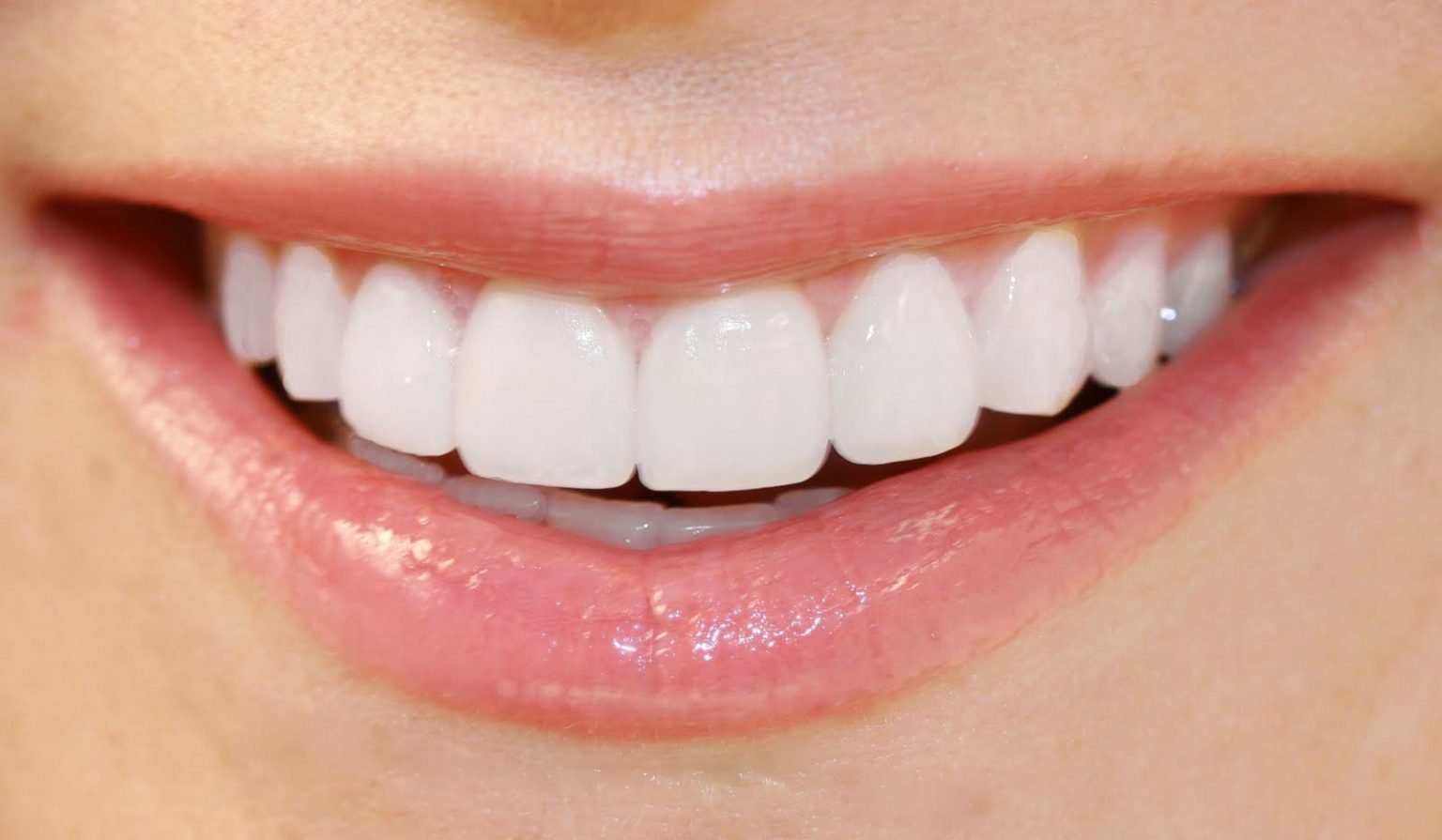 Composite Veneers Vs Porcelain Veneers Langleys Composite Veneers Vs Porcelain Veneers Langleys