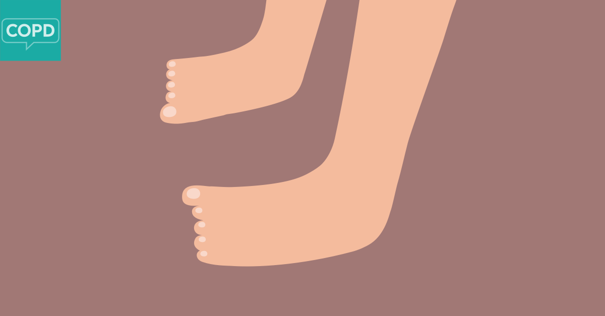 Copd And Feet Swelling