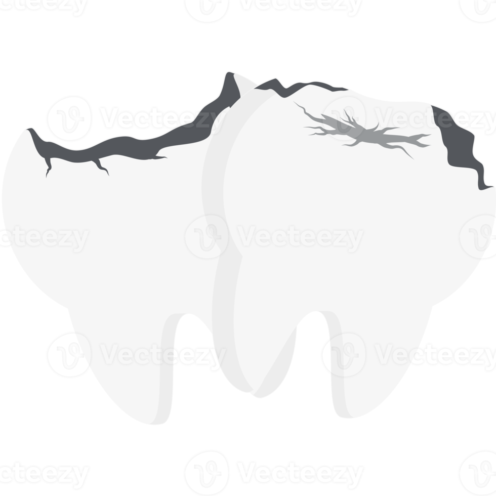 Cracked Tooth With Cavity