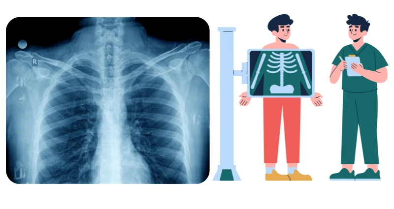 Cracked Tooth X Ray: Diagnose With Precision