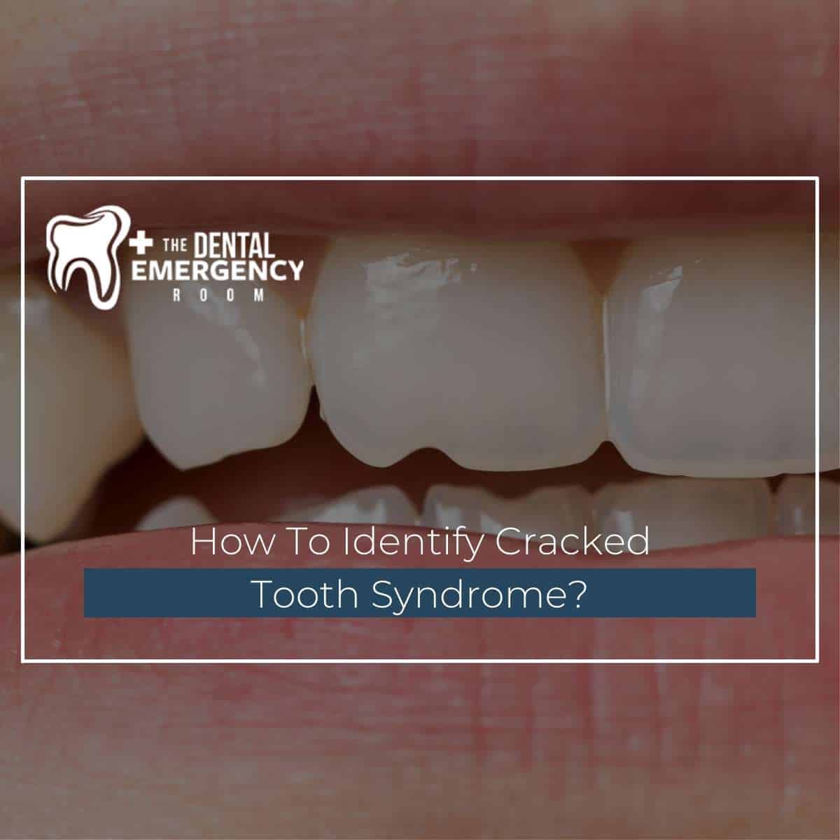 Cracked Tooth X Ray: Identify Damage Easily