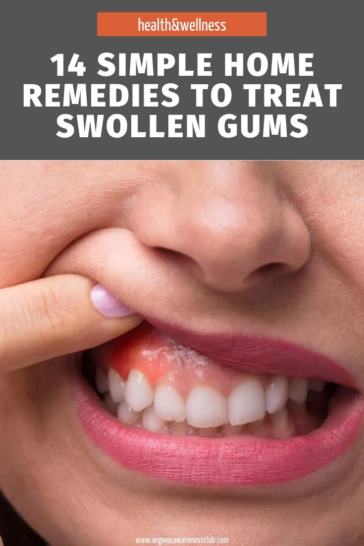 Cut Gums Healing Guide: Pain Relief