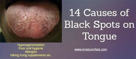 Dark Spots On Tongue