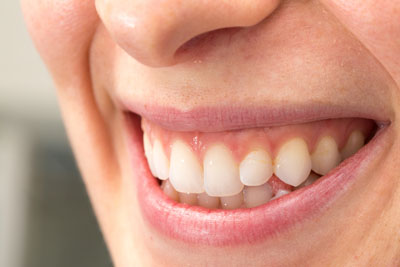 Dental Filling Pain: What To Expect
