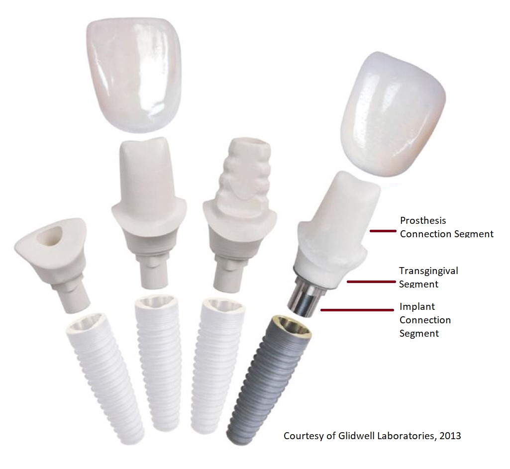 Dental Implant Abutments Dental Implant Abutments