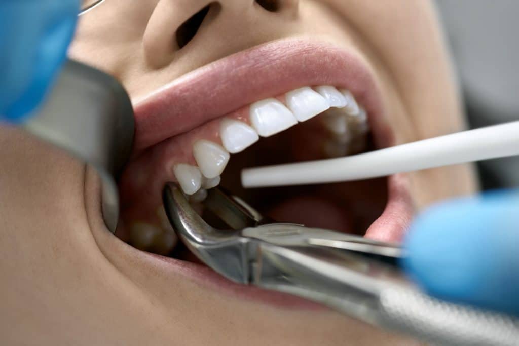 Dentist Tools For Tooth Extraction