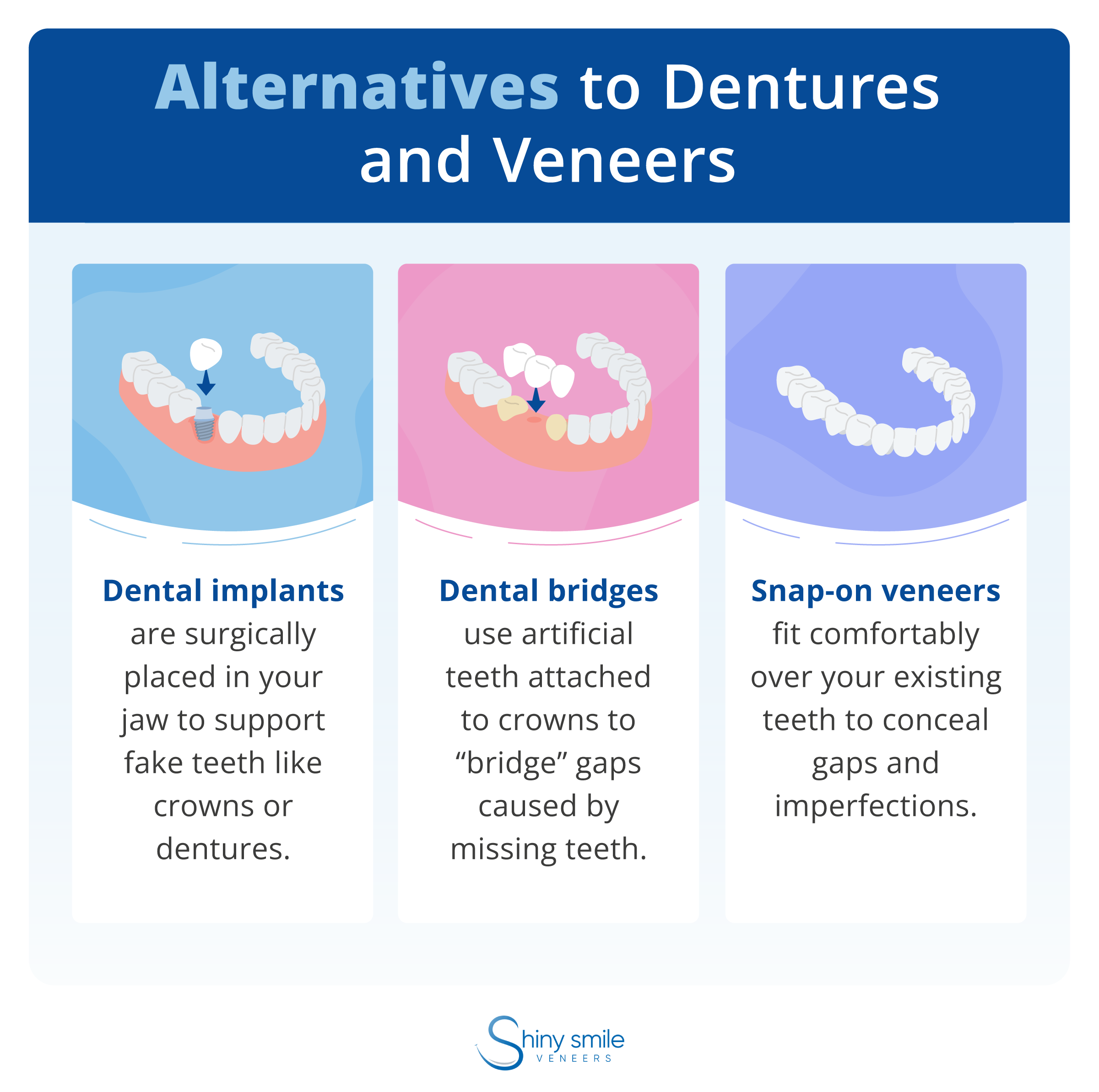 Dentures Or Veneers