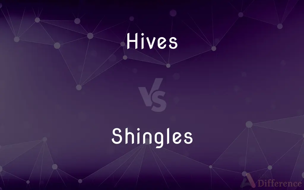 Difference Between Hives And Shingles
