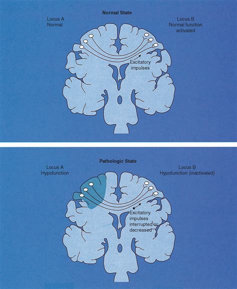 Diffuse Cerebral Dysfunction
