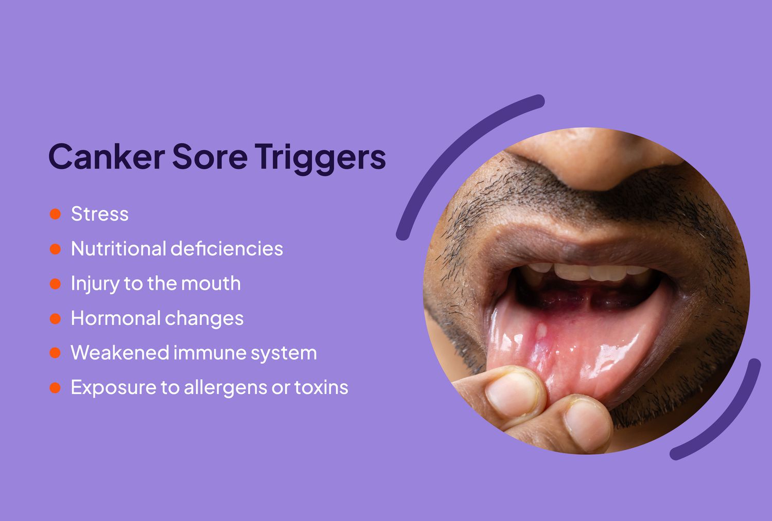 Does Dehydration Cause Canker Sores Does Dehydration Cause Canker Sores