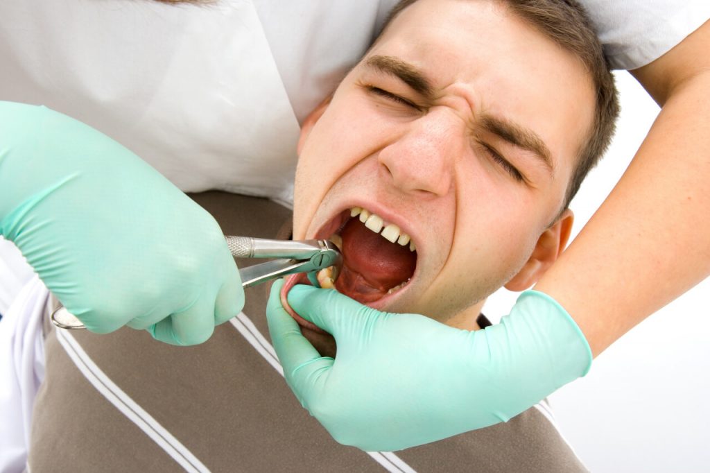 Does Molar Extraction Hurt