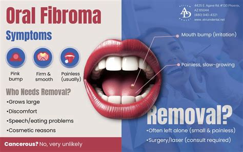 Does Oral Fibroma Go Away