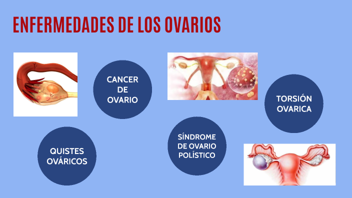 Embarazada Y Dolor De Ovarios