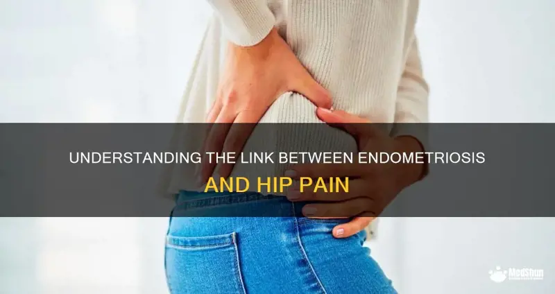 Endo Pain In Hip Endo Pain In Hip