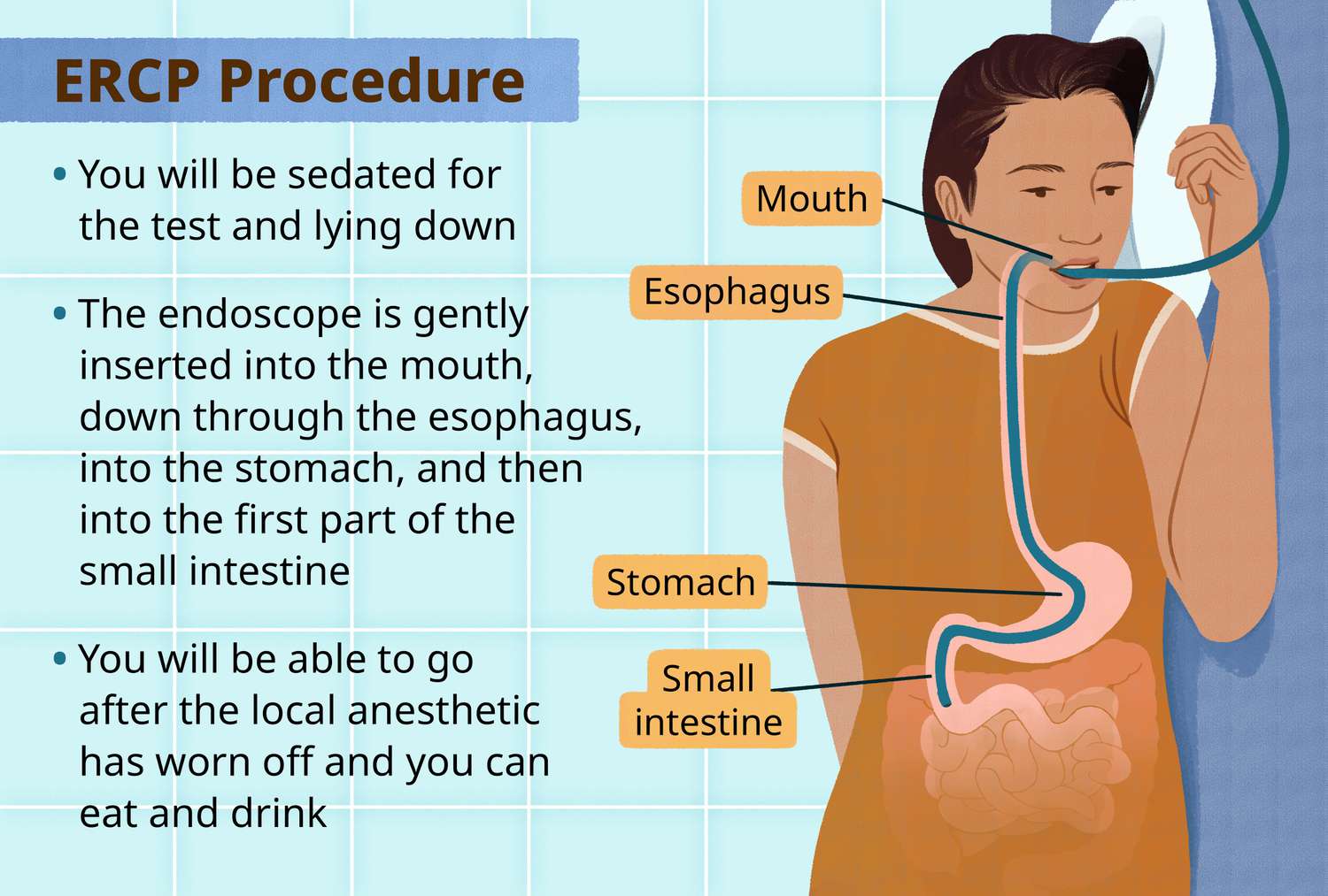 Ercp Vs Hida