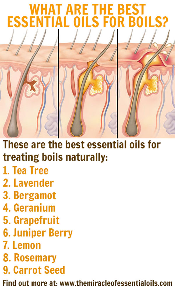 Essential Oils For Boils Essential Oils For Boils