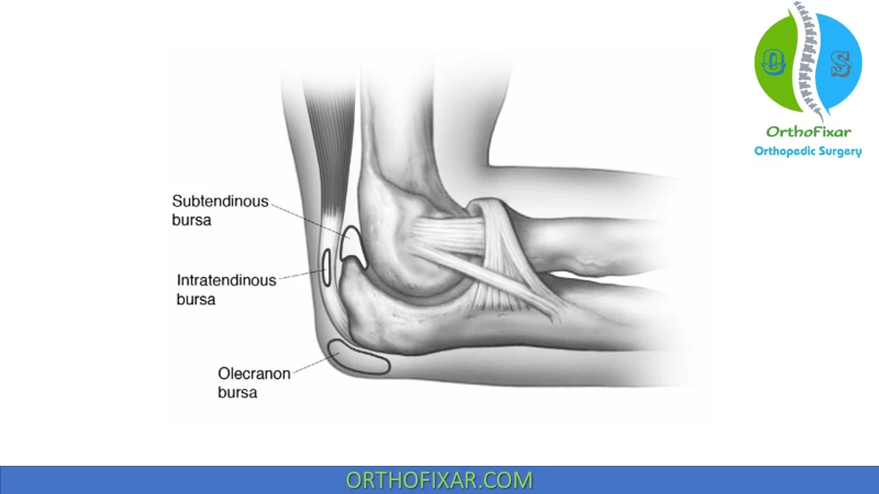Exercises For Olecranon Bursitis