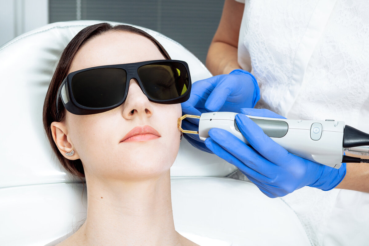 Facial Vascular Lesions