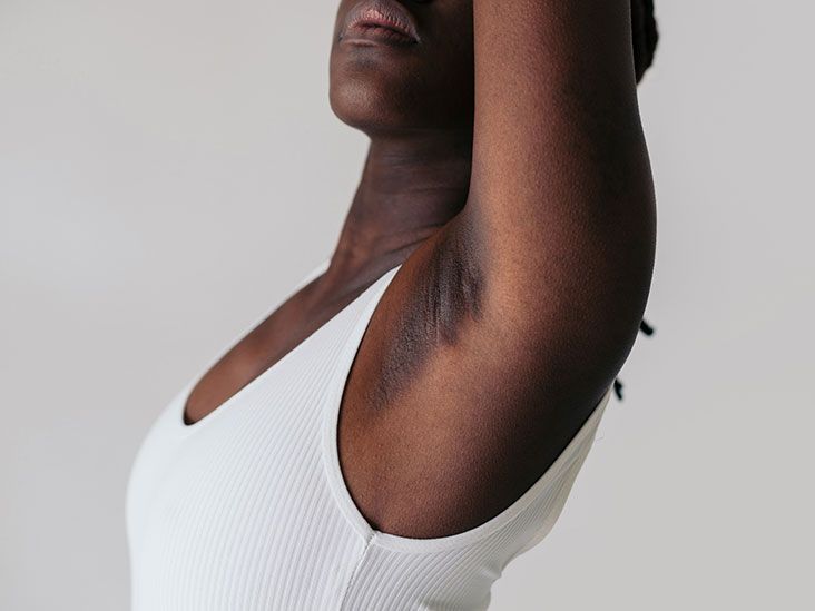 Fibromyalgia And Armpit Pain