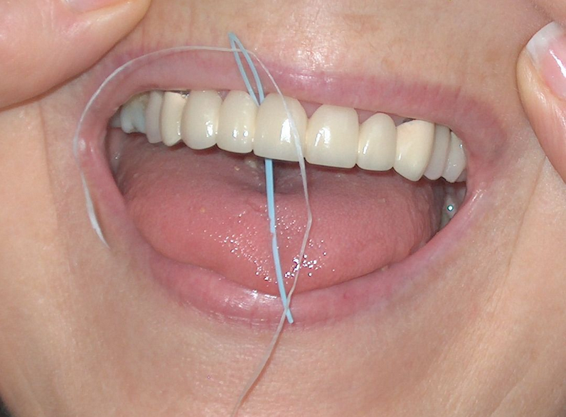 Floss Threader How To Use