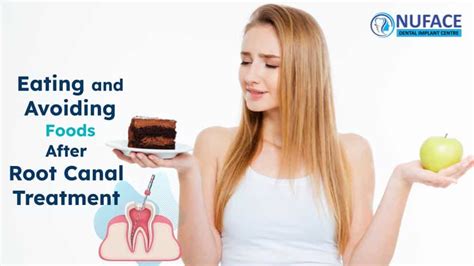 Food After Root Canal