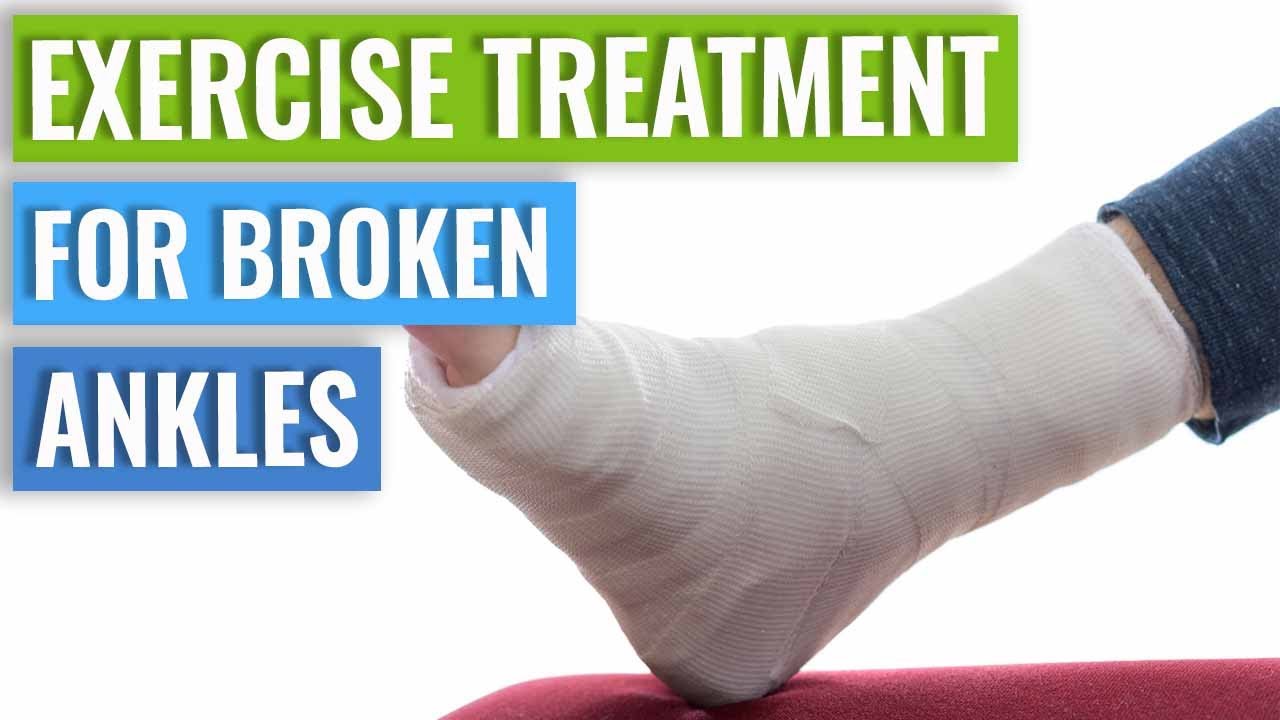 Fracture Recovery: Ice Or Not