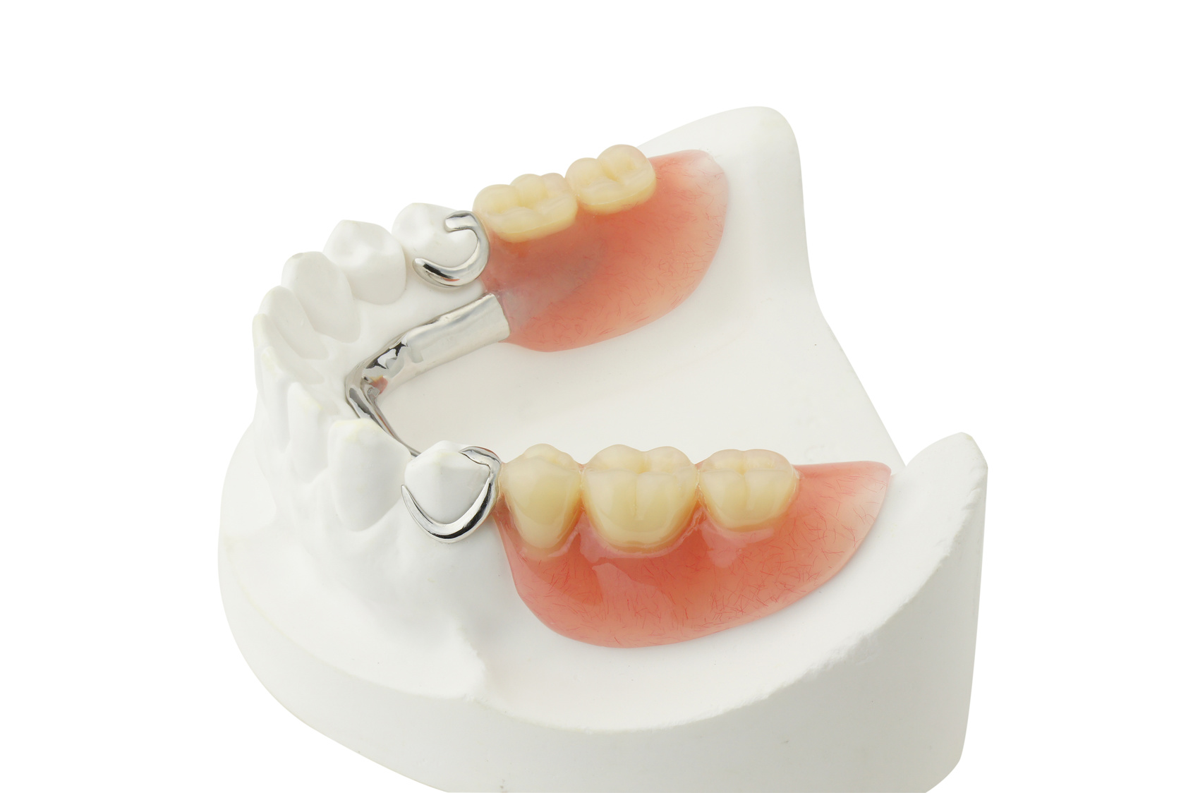 Full Denture Smile