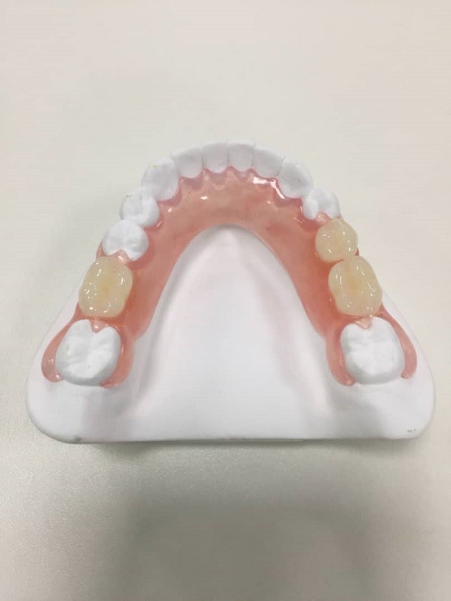 Full Flexible Denture: Comfortable Fit Guaranteed