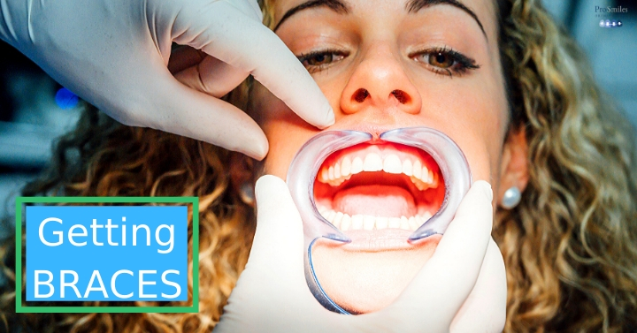 Getting Braces Put On