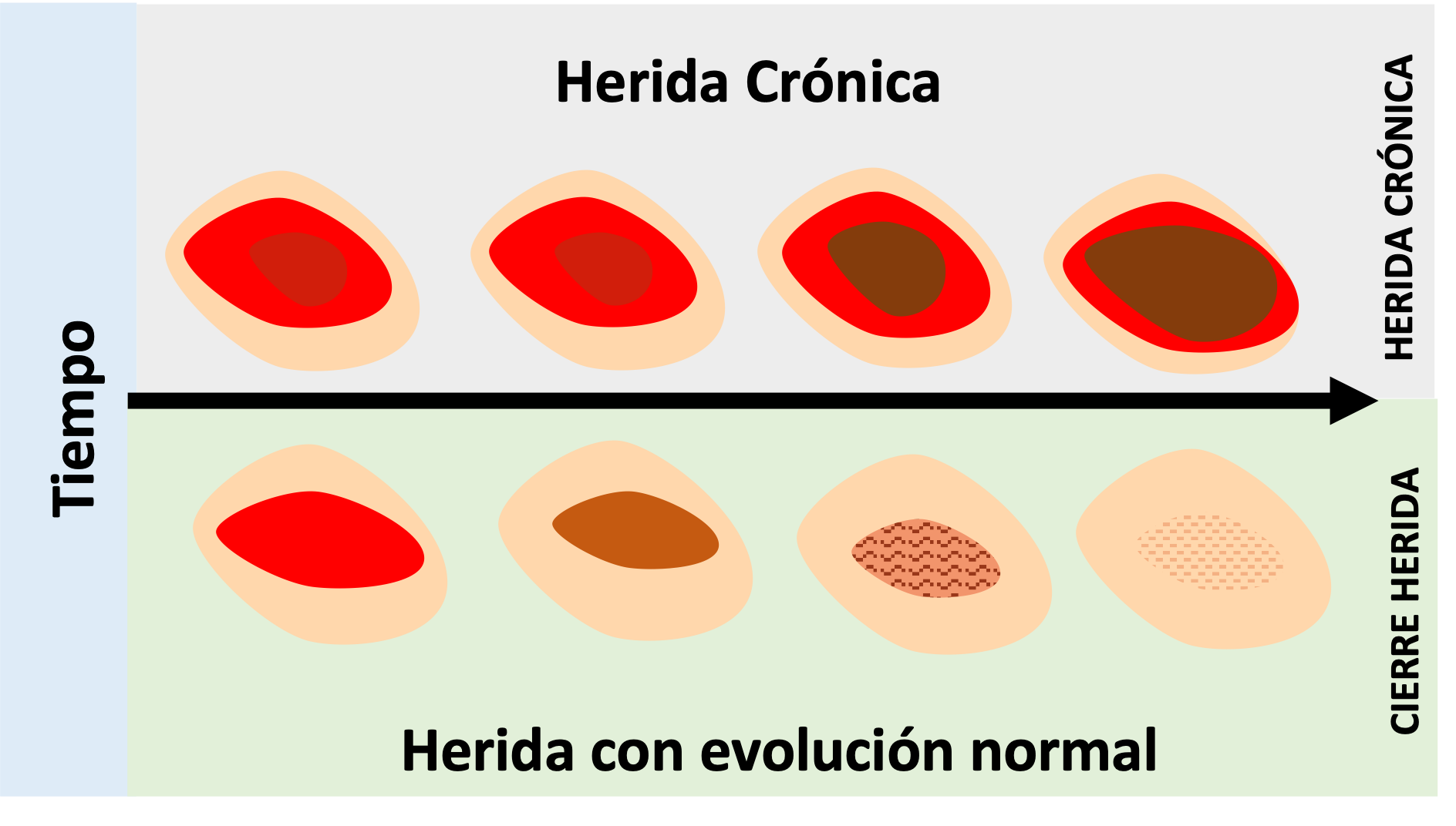 Glande Heridas: Causas Y Remedios Naturales
